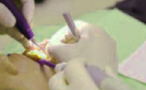 拔牙记作文精华（15篇）