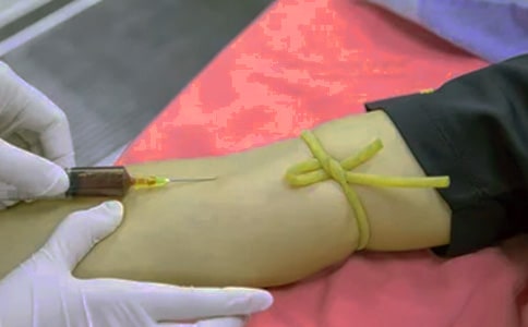 冠心病患者的饮食注意事项介绍