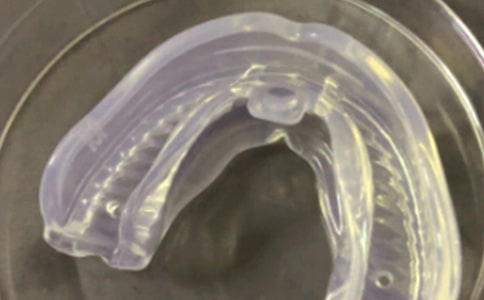 再次换牙套的感受作文