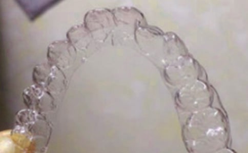 戴牙套作文（通用12篇）